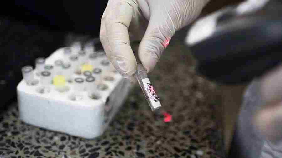 В Роспотребнадзоре рассказали о кожном тесте на иммунитет к COVID-19 В России разрешены испытания…